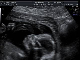 228412_10150241778321061_7199639_n